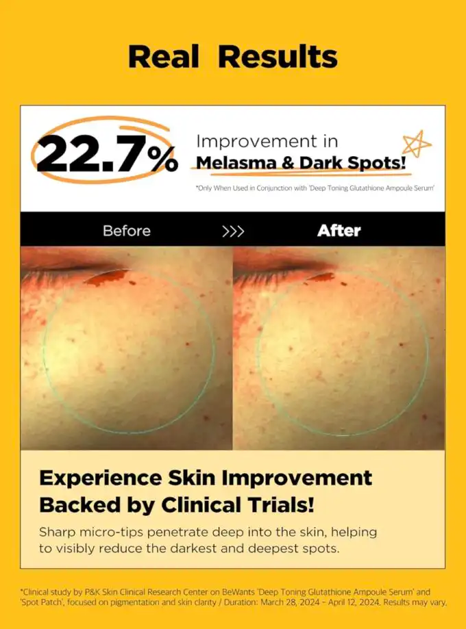 Buy BeWants Glutathione Dark Spot Patch | Clear Acne Marks - Image 7